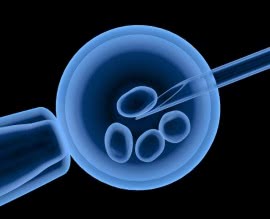 Is IVF becoming more accessible?